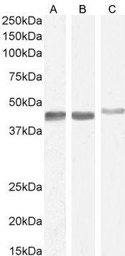 抗-平滑肌 &#945;-肌动蛋白 山羊抗 affinity isolated antibody, buffered aqueous solution