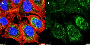 Anti-Dopamine D1 receptor Antibody, clone 2L4 ZooMAb&#174; Rabbit Monoclonal recombinant, expressed in HEK 293 cells