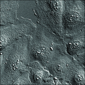 SKOV3 Cells GFP-HER2