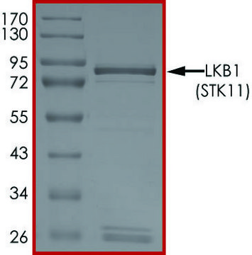 LKB1(STK11) Protein recombinant