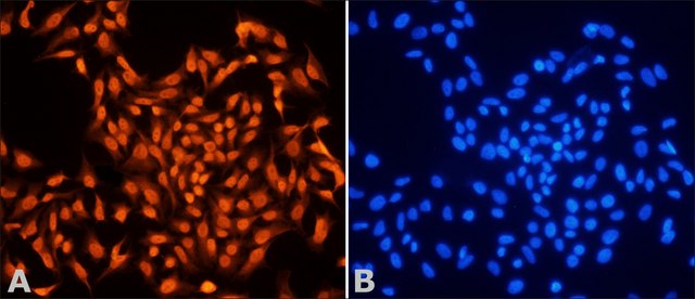 Anti-MSH6 (C-terminal) 兔抗 ~1&#160;&#956;g/L, affinity isolated antibody, buffered aqueous solution