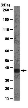 Anti-hnRNP A1 Antibody, clone 9H10 clone 9H10, from mouse