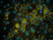 PyMT-1099 Mouse Mammary Tumor EMT Model Cell Line