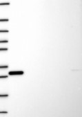 Anti-Kat5 Antibody Produced In Rabbit Prestige Antibodies® Powered by Atlas Antibodies, affinity isolated antibody, buffered aqueous glycerol solution