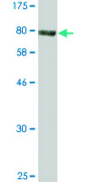 Monoclonal Anti-ACD antibody produced in mouse clone 1C11-1A7, purified immunoglobulin, buffered aqueous solution