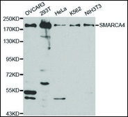 Anti-SMARCA4 antibody produced in rabbit affinity isolated antibody