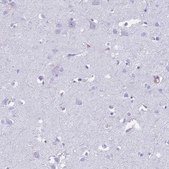 Anti-TNFSF11 antibody produced in rabbit Prestige Antibodies® Powered by Atlas Antibodies, affinity isolated antibody, buffered aqueous glycerol solution