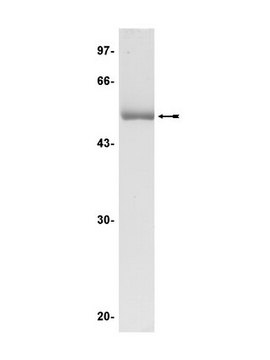 JNK2&#945;2/SAPK1a Protein, inactive, 50 g Unactive, N-terminal His6-tagged, recombinant, full-length, human JNK2&#945;2/SAPK1a unactive, for use in Kinase Assays.