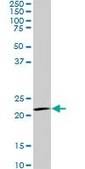 Monoclonal Anti-IL20 antibody produced in mouse clone 2H8, purified immunoglobulin, buffered aqueous solution