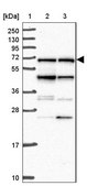 Anti-NCOA5 antibody produced in rabbit Prestige Antibodies® Powered by Atlas Antibodies, affinity isolated antibody, buffered aqueous glycerol solution
