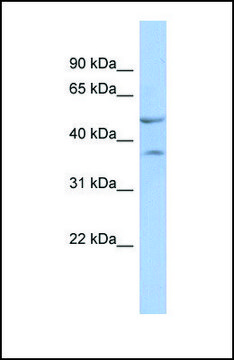 Anti-NKX6-1, (N-terminal) antibody produced in rabbit affinity isolated antibody