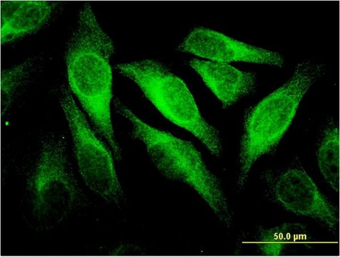 Monoclonal Anti-CEACAM6 antibody produced in mouse clone 1G2, purified immunoglobulin, buffered aqueous solution