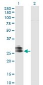 Monoclonal Anti-EPDR1 antibody produced in mouse clone 1C1, purified immunoglobulin, buffered aqueous solution