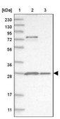 Anti-PSMA5 antibody produced in rabbit Prestige Antibodies® Powered by Atlas Antibodies, affinity isolated antibody, buffered aqueous glycerol solution, ab1