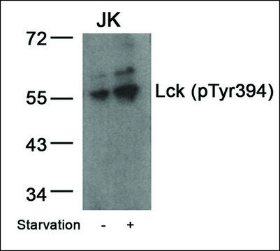 抗-磷酸-LCK (pTyr394) 兔抗 affinity isolated antibody