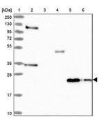 Anti-IL17B antibody produced in rabbit Prestige Antibodies® Powered by Atlas Antibodies, affinity isolated antibody, buffered aqueous glycerol solution