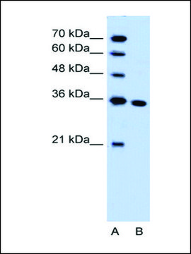 Anti-SLC25A29 antibody produced in rabbit IgG fraction of antiserum