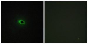 Anti-Collagen XII α1 antibody produced in rabbit affinity isolated antibody