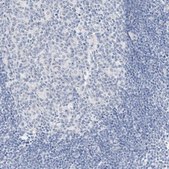 Anti-SLC22A13 antibody produced in rabbit Prestige Antibodies® Powered by Atlas Antibodies, affinity isolated antibody, buffered aqueous glycerol solution