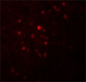 Anti-TSPAN9 antibody produced in rabbit affinity isolated antibody, buffered aqueous solution