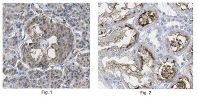 抗-ALKBH1抗体 from rabbit, purified by affinity chromatography