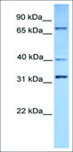 Anti-SUZ12 antibody produced in rabbit affinity isolated antibody