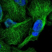 Anti-CDC42EP2 antibody produced in rabbit Prestige Antibodies® Powered by Atlas Antibodies, affinity isolated antibody, buffered aqueous glycerol solution