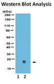Di-Ubiquitin (Lys63-linked) Recombinant Protein Native K63 linked Di-Ubiquitin which can be used as a substrate for proteases that cleave the isopeptide linkage between two ubiquitin molecules.