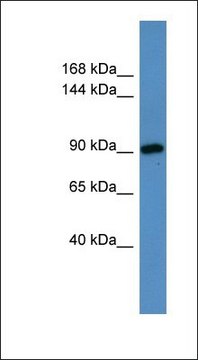 Anti-HPS3 antibody produced in rabbit affinity isolated antibody