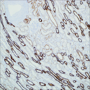 Ksp-cadherin (MRQ-33) Mouse Monoclonal Antibody