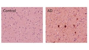 Anti-phospho-Tau (Ser235) Antibody, clone RN235 clone RN235, from mouse