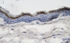 Anti-Collagen Type VII Antibody, clone NP32 ZooMAb® Mouse Monoclonal recombinant, expressed in HEK 293 cells