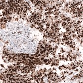 Monoclonal Anti-Msh2 Antibody Produced In Mouse Prestige Antibodies® Powered by Atlas Antibodies, clone CL13724, affinity isolated antibody, buffered aqueous glycerol solution