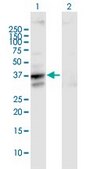 Anti-SLC25A3 antibody produced in mouse IgG fraction of antiserum, buffered aqueous solution