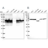 Anti-STIP1 antibody produced in rabbit Prestige Antibodies® Powered by Atlas Antibodies, affinity isolated antibody, buffered aqueous glycerol solution