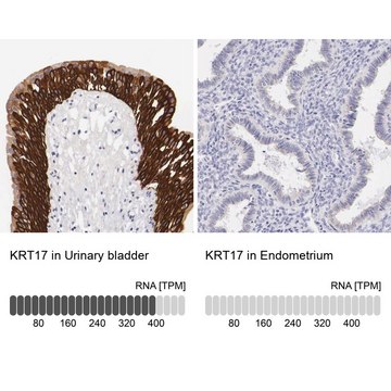 Anti-KRT17 antibody produced in rabbit Ab2, Prestige Antibodies&#174; Powered by Atlas Antibodies, affinity isolated antibody, buffered aqueous glycerol solution