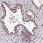 Anti-TMED5 antibody produced in rabbit Prestige Antibodies® Powered by Atlas Antibodies, affinity isolated antibody, buffered aqueous glycerol solution