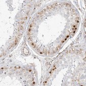 Anti-DMRTB1 antibody produced in rabbit Prestige Antibodies® Powered by Atlas Antibodies, affinity isolated antibody, buffered aqueous glycerol solution