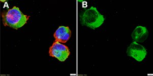 Anti-PLVAP Antibody, clone 3K18 ZooMAb® Rabbit Monoclonal recombinant, expressed in HEK 293 cells