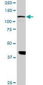 Monoclonal Anti-ADAMTS17 antibody produced in mouse clone 3B7, purified immunoglobulin, buffered aqueous solution