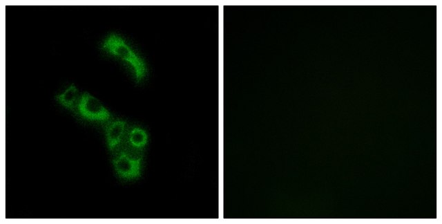 Anti-C1QB, C-Terminal antibody produced in rabbit affinity isolated antibody