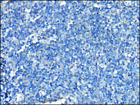 Anti-UFC1 affinity isolated antibody