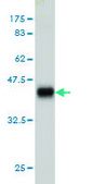 Monoclonal Anti-ASCL1 antibody produced in mouse clone 7E11, purified immunoglobulin, buffered aqueous solution