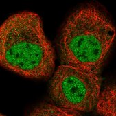Anti-KLHDC10 antibody produced in rabbit Prestige Antibodies® Powered by Atlas Antibodies, affinity isolated antibody, buffered aqueous glycerol solution