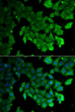 Anti-LC3A/LC3B antibody produced in rabbit