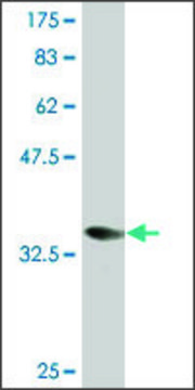 Monoclonal Anti-CORO1A, (C-terminal) antibody produced in mouse clone 1A8, purified immunoglobulin, buffered aqueous solution