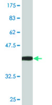 Monoclonal Anti-LATS1 antibody produced in mouse clone 3A7, purified immunoglobulin, buffered aqueous solution