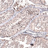 Monoclonal Anti-GLI1 antibody produced in mouse Prestige Antibodies® Powered by Atlas Antibodies, clone CL12192, purified immunoglobulin, buffered aqueous glycerol solution