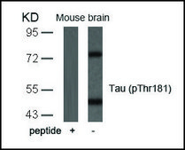 Anti-phospho-MAPT (pThr181) antibody produced in rabbit affinity isolated antibody