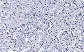 Anti-Interferon γ Antibody, clone 1N13 Antibody, ZooMAb® Rabbit Monoclonal recombinant, expressed in HEK 293 cells